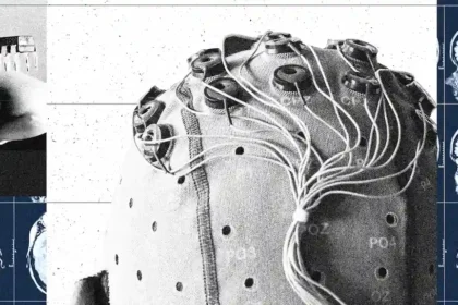 China Is Building a Brain-Computer Interface Industry