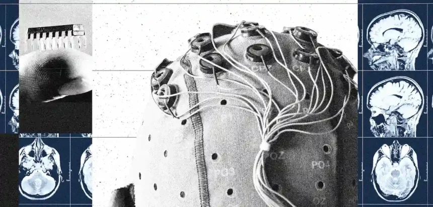 China Is Building a Brain-Computer Interface Industry